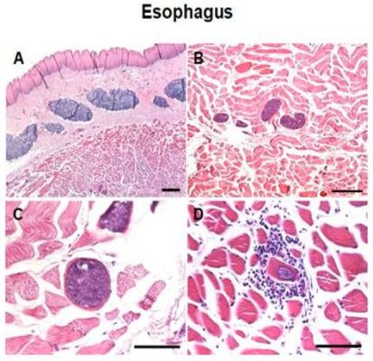 Sarcocystis! A Parasite That Can Turn Your Muscles Into Miniature Beef Stew