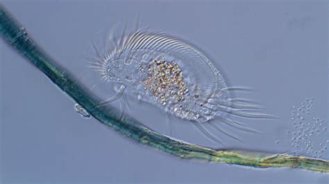  Xenophryxus! The Undiscovered Ciliate Champion of Microscopic Wrestling Matches