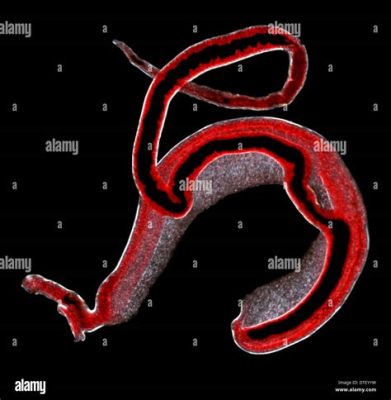  Blood Fluke - A Masterful Parasite Navigating Human Blood Vessels!