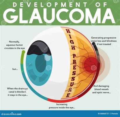  Glaucoma: Ten mikroskopowy drapieżnik potrafi zmienić kształt w mgnieniu oka!