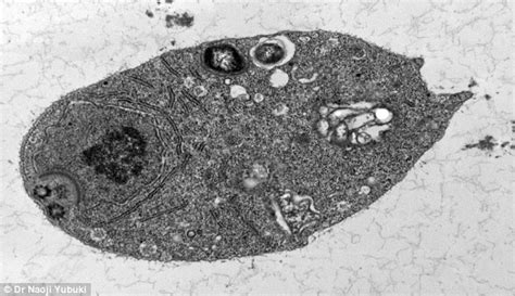  Monocercomonoides:  The Single-Celled Enigma That Challenges Everything We Thought We Knew About Mitochondria!