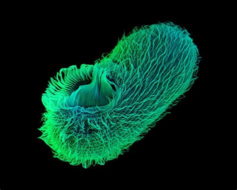  Tetrahymena!  A Tiny Aquatic Tornado That Swirls Through Microscopic Worlds