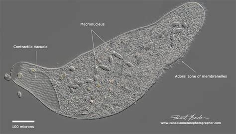   Xerodromema! A Ciliate That Lives Where You Least Expect It!