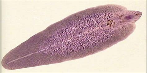  Zoogonus:  A Tiny Trematode That Embarks on a Bizarre Journey Through Multiple Hosts!